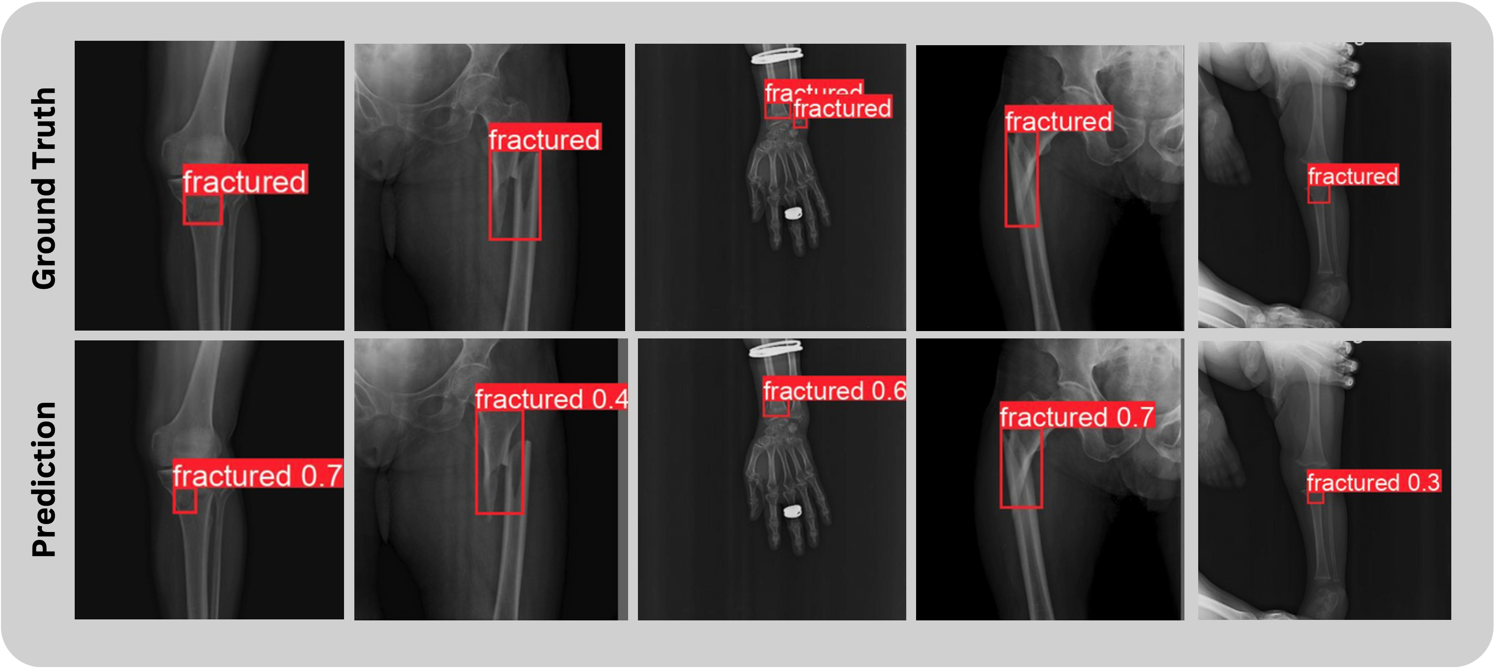 Fracture Detection Results