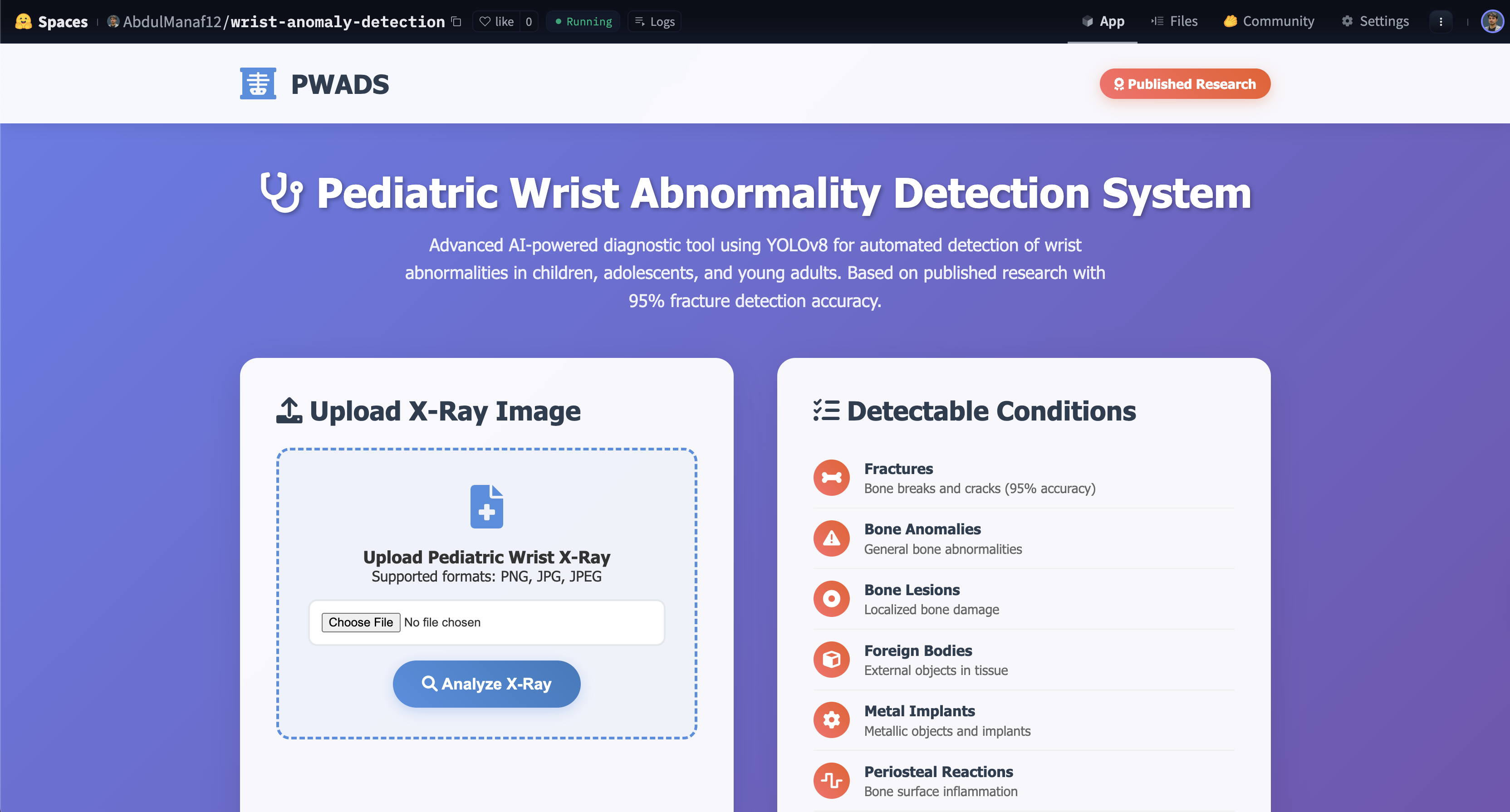 Pediatric Wrist Abnormality Detection System Demo Preview